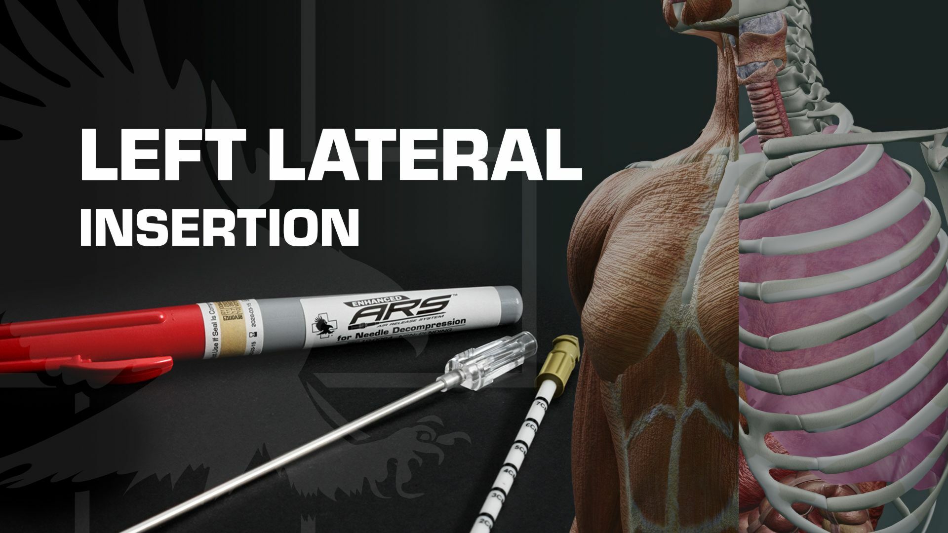 Learn About Left lateral Insertion When Treating a Tension Pneumothorax