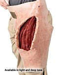 SMRT Task Trainer - Hip with Large Caliber Gunshot Wound