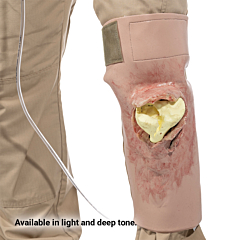SMRT Task Trainer - Tibia Head Fracture