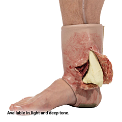 SMRT Task Trainer - Ankle Fracture