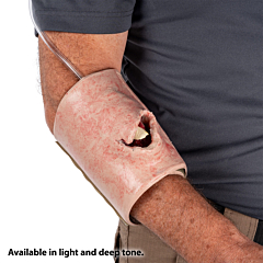 SMRT Task Trainer - Open Fracture (Versatile Placement)