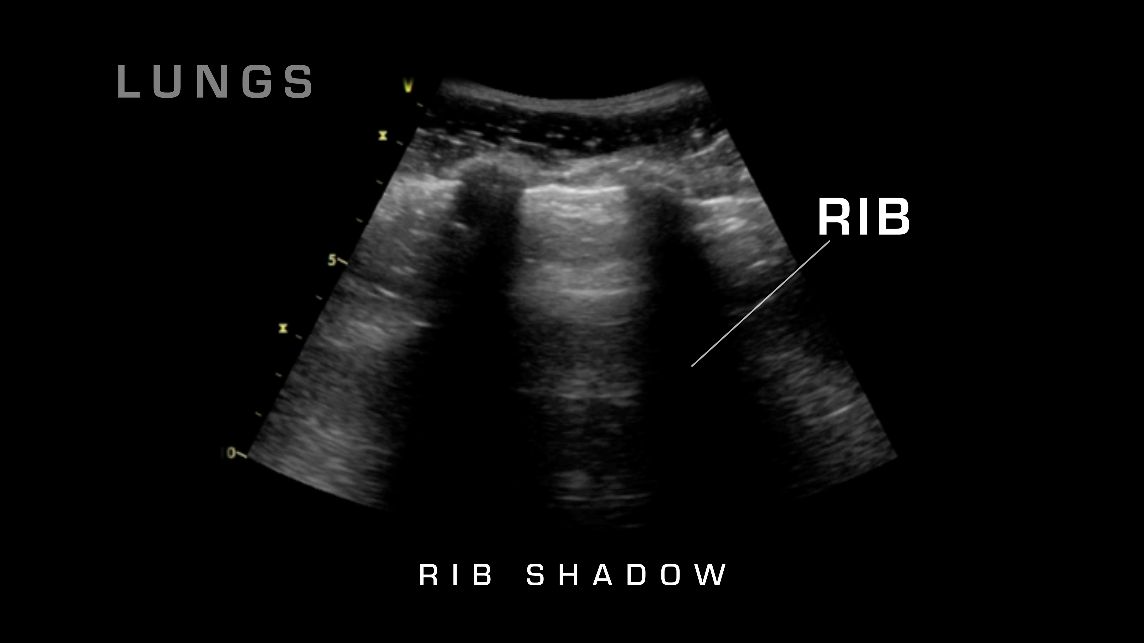 rib shadow