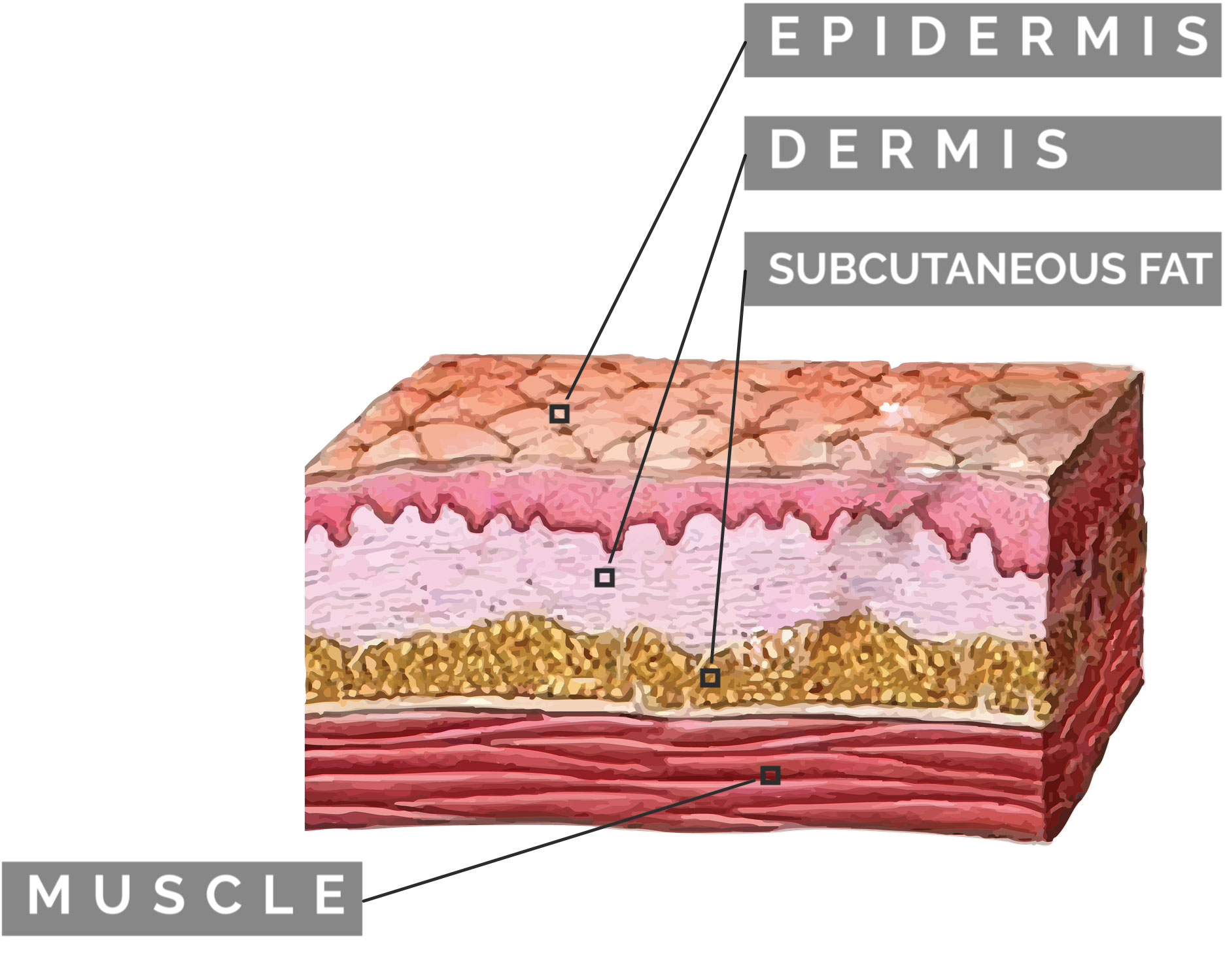 wound closure 101 - part 2 blog wound closure 101 - part 2