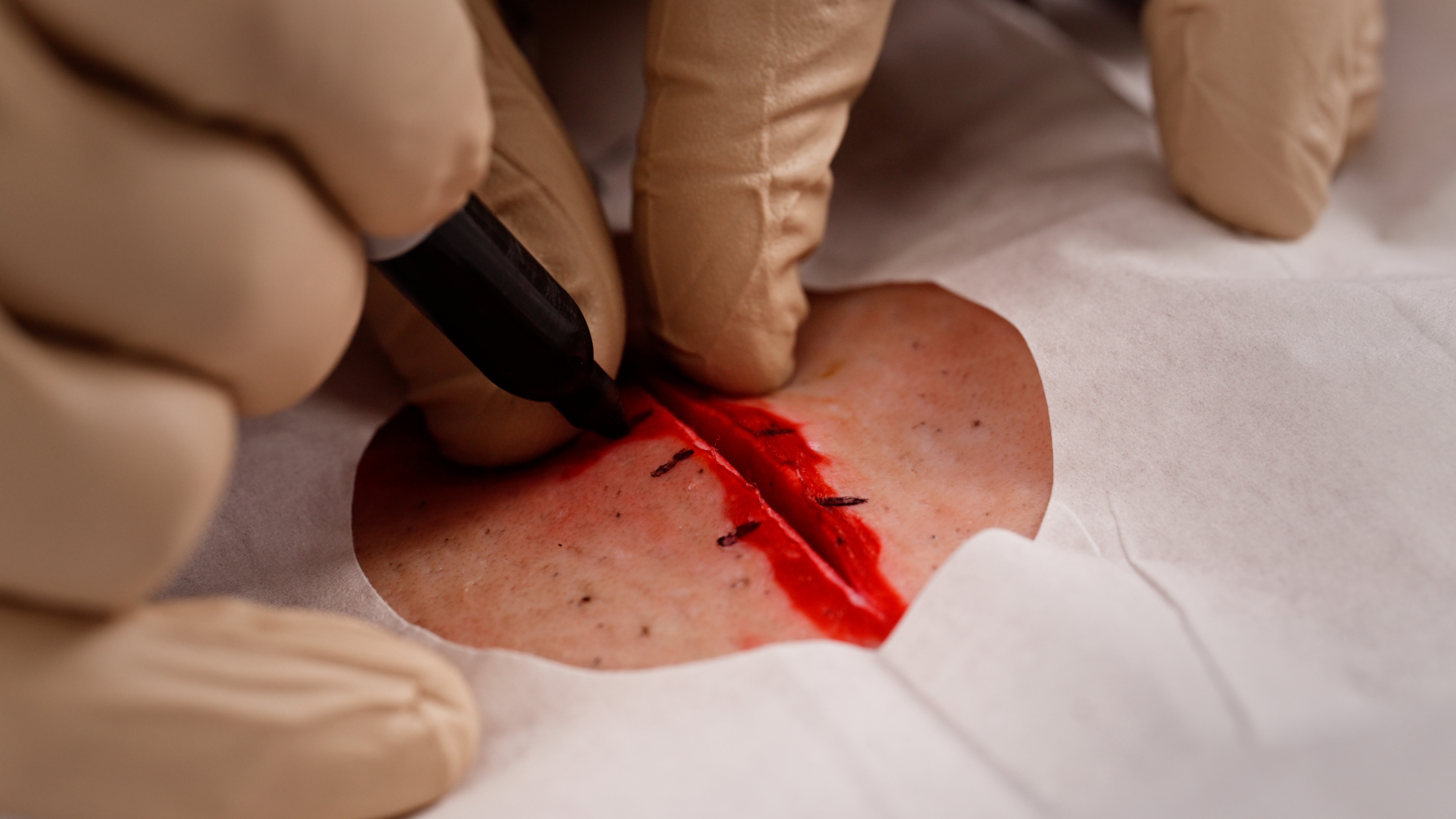 Wound Closure 101 Pt 1 Studies Wound Closure 101 Pt 1 Studies