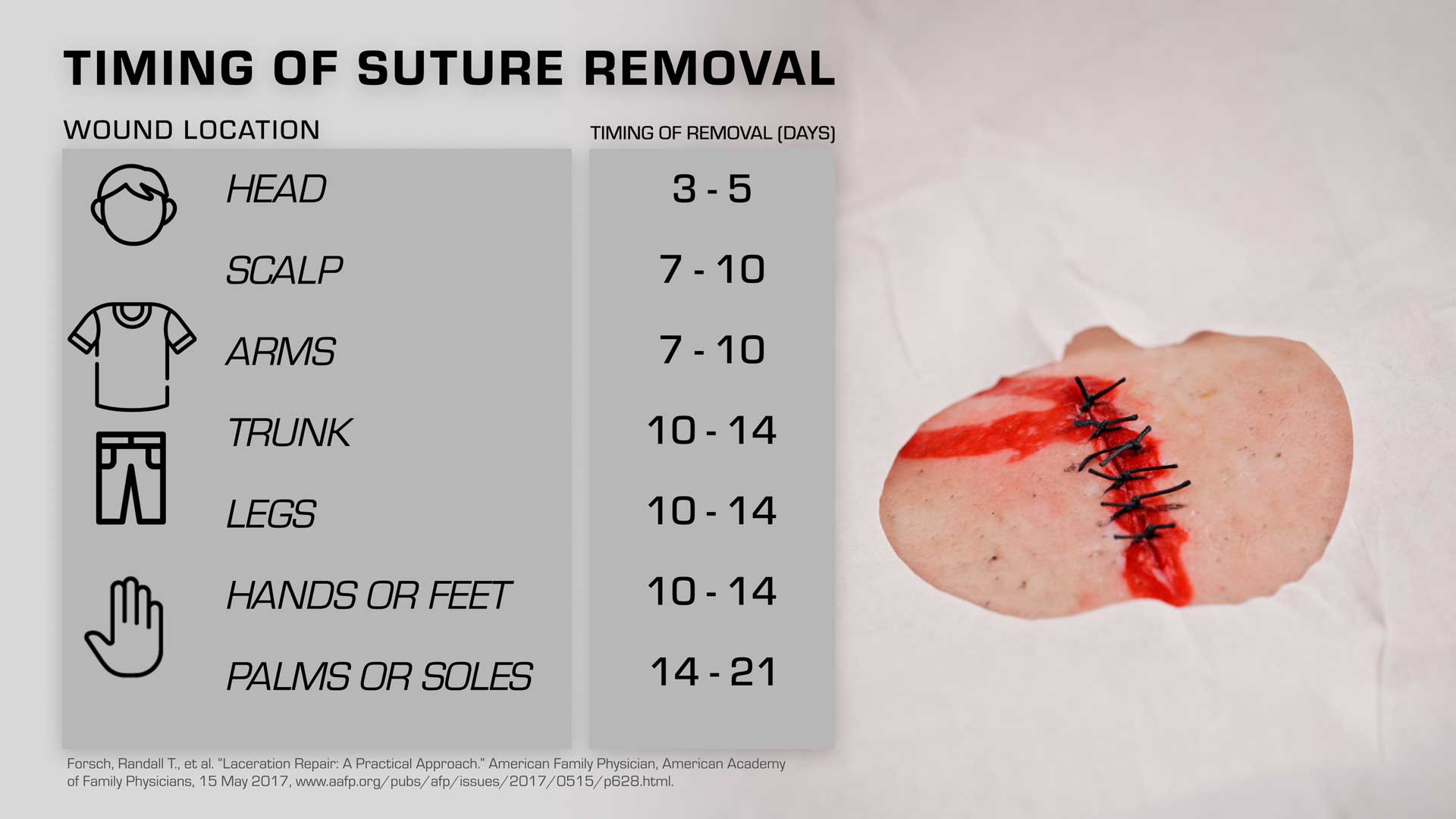 Wound Closure 101 Pt 1 Studies Wound Closure 101 Pt 1 Studies