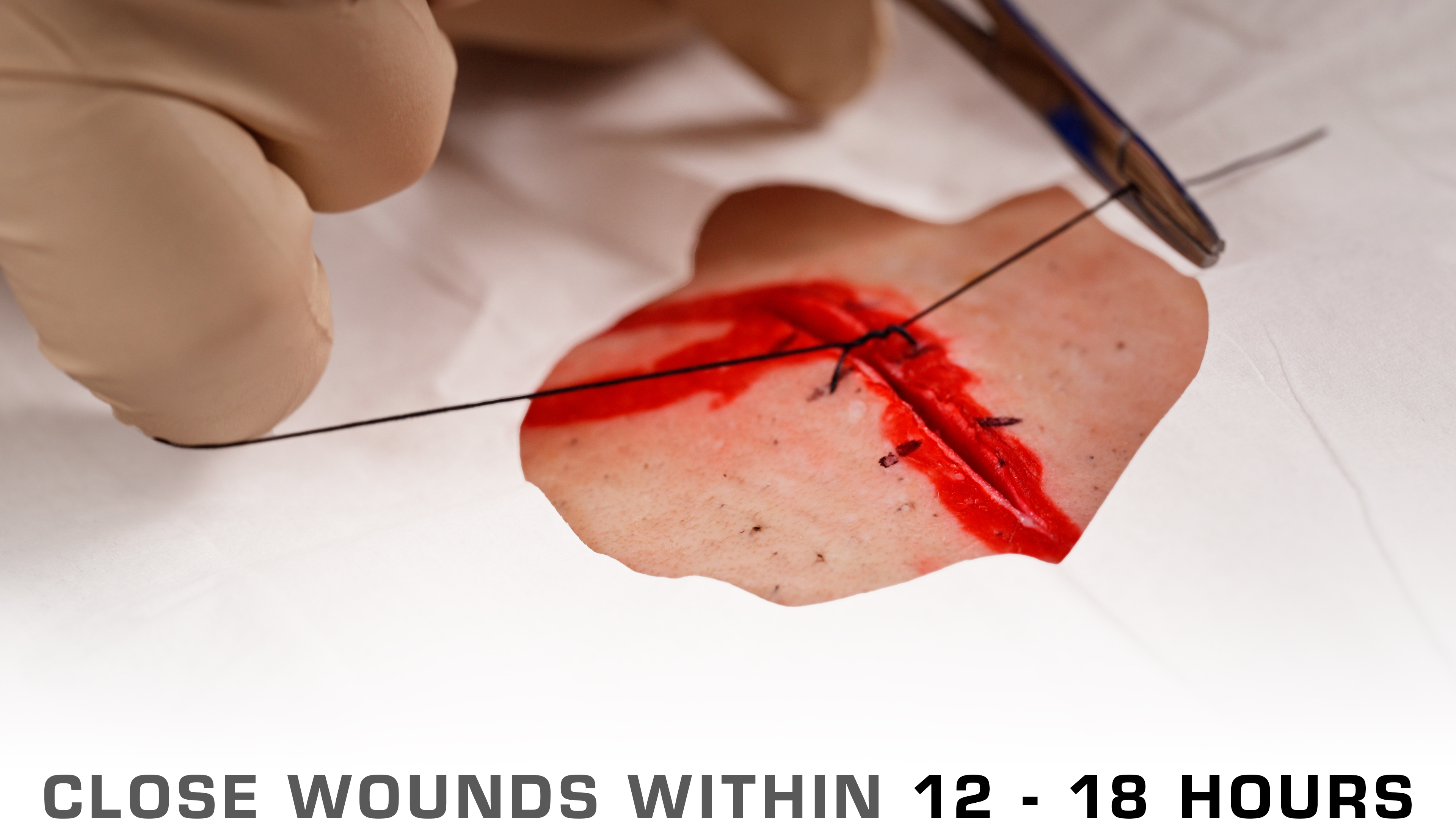 wound closure 101 - part 1 blog wound closure 101 stitches